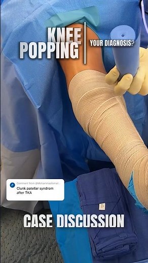 Why Patellar Clunk Syndrome is a BIG Problem for Knee Replacements