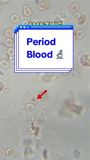 Exploring Menstrual Blood Under the Microscope
