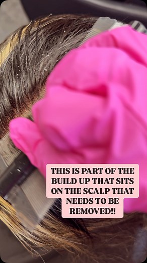 NO LICE HERE!! 😱😱😳😳 Just some dead cell removal!! Isn’t kinda satisfying to watch it all come up and out!!! #scalphealth #scalpfacial #haircare #headspaidaho #hairtips #idahofalls #scalphealthmatters | Rachelle Schaat