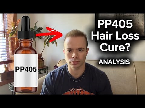 PP405 Could Cure Hair Loss IF These Conditions are Met