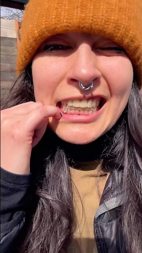 Serving Hawley Retainer Realness