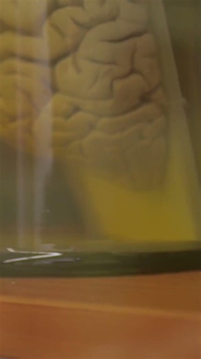How Long-Term Memory Is Formed in the Brain 🧠 | Neuroscience Explained