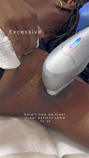 Advanced treatment for excessive underarm sweating 💧