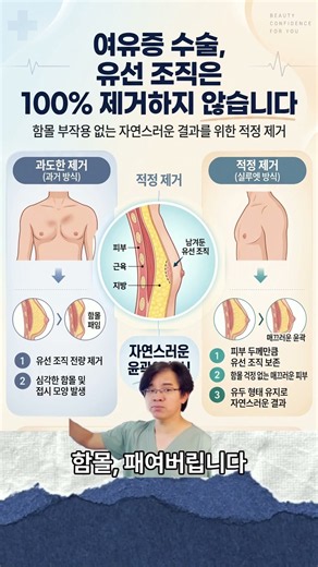 유선조직을 100% 제거하면 함몰 생기는거 아세요? #유선조직제거