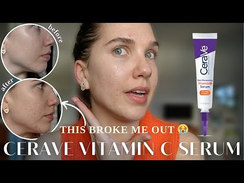 CeraVe Skin Renewing Vitamin C Serum 30 Day Review | Acne-Prone + Sensitive Skin