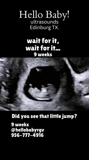 🤗 Come see your baby as early as 6 weeks into pregnancy! ☺️ Appointments are available everyday 11am-7pm 📲 Call us at 956-777-4916 to schedule yours today! #rgvmoms #956 #edinburgtx #mcallentx #pregnancy