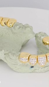 19K views · 194 reactions | 399.Peepthese yellow gold invisible set grills略they don’t call me number one for no reason#diamondboyz #grillz #diamonds #gold #houston#nocap | Johnny Dang | Facebook