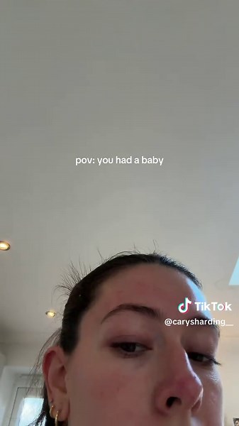 IYKYK 🫠🫠🫠🫠🫠 #pospartum #postpartumhairloss #hairregrowth | postpartum