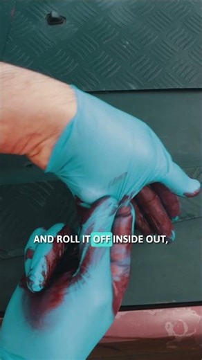 How To Remove Contaminated Gloves #clinicaleducation #ems #paramedic #medicalhacking