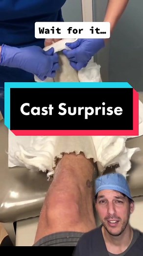 Cast Saw Removal Procedure Explained