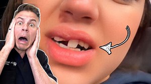 Can a retainer fix your teeth back straight… let’s find out!! 😳 #retainers #braces #teeth | TheBentistofficial