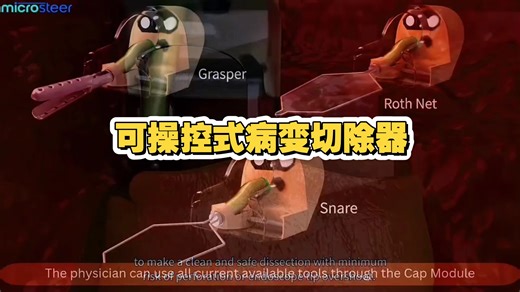 MicroSteer内镜下可操控式病变切除器