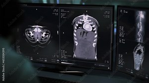 Medical exam procedure scanning the body of the sick patient at the clinic. Medical exam procedure searching for disease cells. Medical exam procedure inspecting the organs with the x-ray.