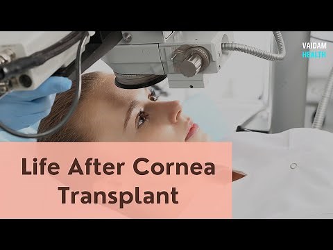 Life After Cornea Transplant