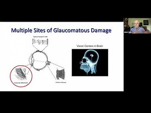 Using Genetics and Genomics to Identify Novel Glaucoma Pathogenic Pathways