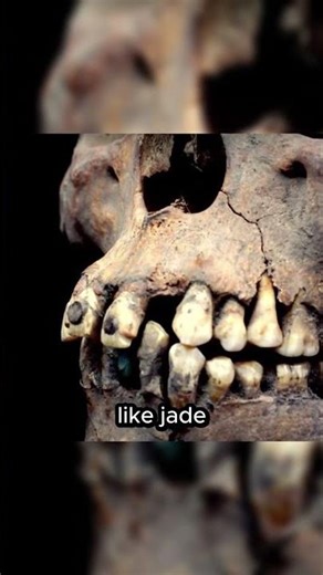 The Teeth Inlaid With Precious Stones