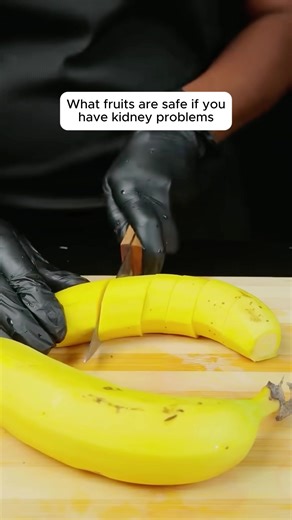 Kidney-Friendly Fruits for Kidney Health