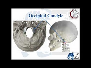 Spine Trauma (3): Occipital Condyle fracture إصابات العمود الفقري