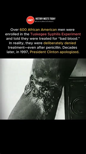 They Had the Cure and Refused to Use It #Tuskegee #History