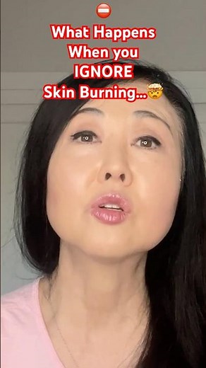 What Happens when you Ignore Your Skin Burning #goseechristy #whydoesmyskinburn