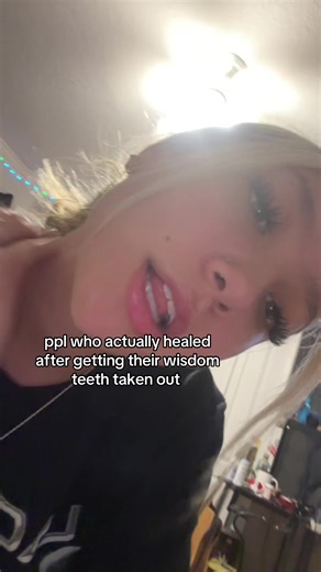 Wisdom Teeth Removal Healing Journey