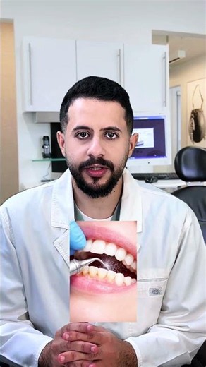 Gum Irritation with Dr Abdullah