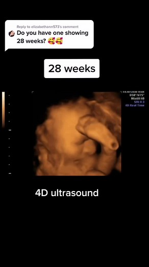 Pregnancy Update: 28 Weeks 4D Ultrasound