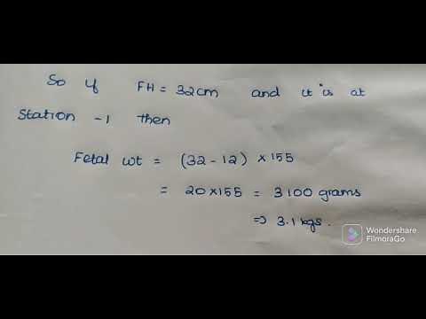 #Johnson's formula |# fetal weight formula |#obstetrics| #learnmedicinewithswe