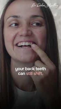 Fixed Retainers: 3 Things You Probably Didn’t Know