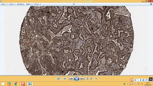 如何从HPA数据库下载免疫组化原图