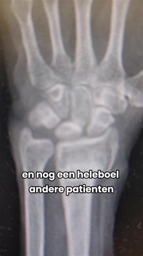 Ga mee naar mijn dienst op de spoedeisende hulp! En mijn boek is nu te pre-orderen bij je favoriete (online) boekwinkels! Hollen en halen🤩🤩🤩 #spoedeisendehulp #geneeskunde #boektok