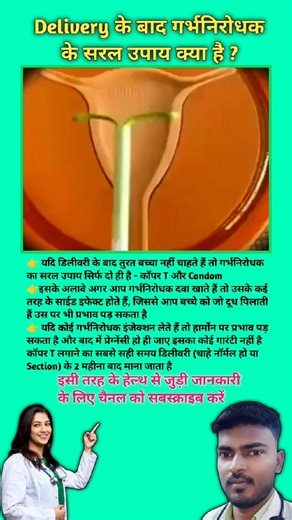 Delivery के बाद गर्भनिरोधक के सरल उपाय क्या है ? Birth Control tips || #viral #pregnancytips