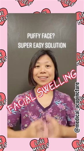 You may occasionally wake up with a swollen, puffy face. This could happen as a result of pressure being placed on vour face while sleeping. However, a swollen, puffy face can also arise from a facial injury or indicate an underlying medical condition.Facial swelling doesn't iust include the face, but it can also involve the neck or throat.If there are no injuries to the face, facial swelling can indicate a medical emergency. In most cases, a medical professional should treat facial swelling. Ho