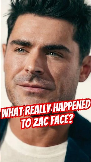 Zac Efron’s Face Changed But Why? Before and After Transformation #zaceffron #beforeandafter