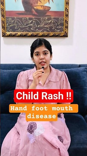 🦠 How To Treat Hand, Foot And Mouth (HFMD) Disease #handfootmouthdisease