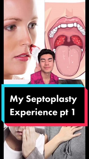 My ✨Septoplasty experience✨ Follow for part 2 - the aftermath of the surgery! 😙 #septoplasty #surgery #deviatedseptum #medicine #education