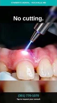 Told you need gum surgery? There's a better way. #shorts