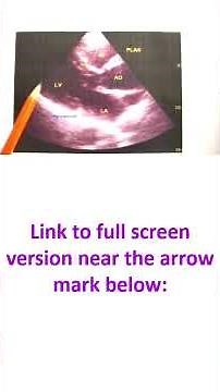 Basic Transthoracic Echocardiography: A Complete Guide to the 5 Essential Views