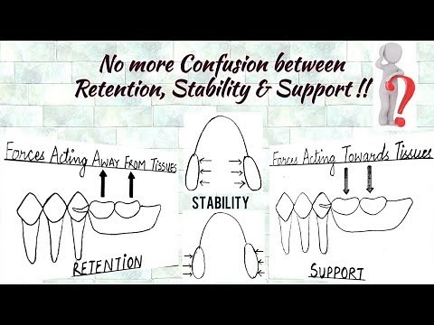 Understanding the concept of Retention, Stability and Support in Prosthodontics