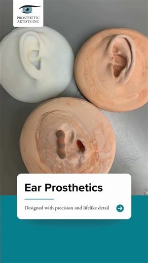 What Prosthetics Do We Specialize In?