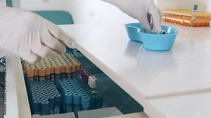 storage of blood test tubes. The lab technician opens the drawer for storing test tubes and takes out various medical devices and test tubes.