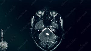 Computer image of a brain during MRI procedure