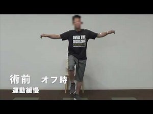 繰り返すジスキネジアと無動（パーキンソン病のヨーヨー現象）