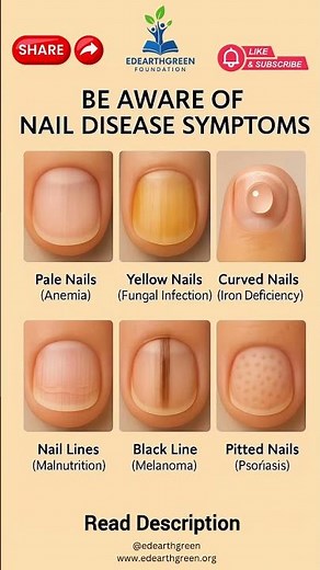 Nail Disease Warning Signs You Should Never Ignore | Nail Health SymptomExplained #healthylifestyle
