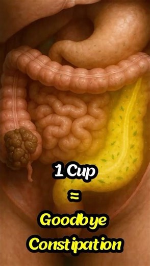 5 Natural Ways to Relieve Constipation Fast