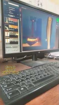 Knee AP/LAT & Fibula Tibia AP/LAT X-ray view