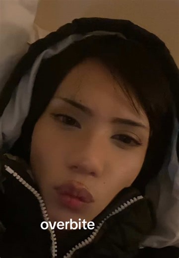 draft #hi | overbite