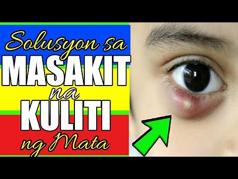 PINAKA MABISANG GAMOT SA KULITI o BUTLIG sa MATA| TANGGAL PANGANGATI NG TALUKAP AT IMPEKSIYON!