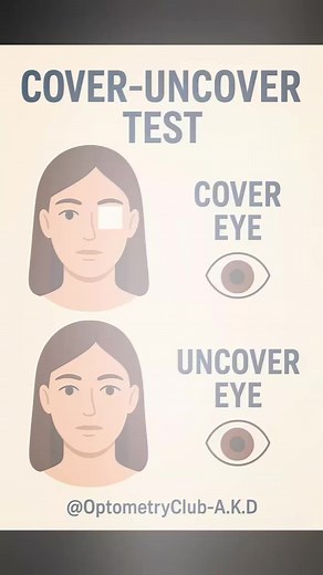 36K views · 570 reactions | The cover-uncover test is used to...