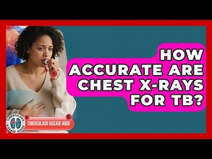 How Accurate Are Chest X-rays For TB? - Tuberculosis Disease Guide